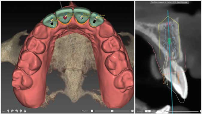 Newsfeed Thumbnail: /product_images/K/Kavo_Kerr_Group/Web_Images/Kavo-Kerr_DTX-Studio_Web.jpg