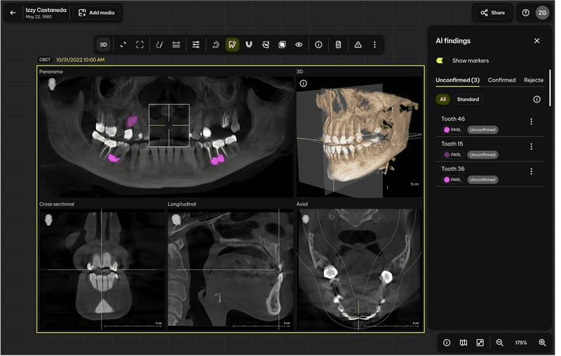 Newsfeed Thumbnail: CORP-press-release-image-Smart-View-Detect-3.png