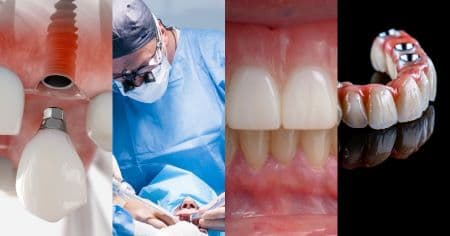 Implant workshops.jpg