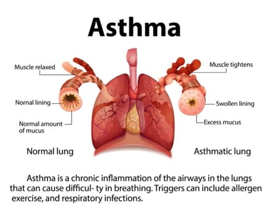 asthmadocs00.jpg