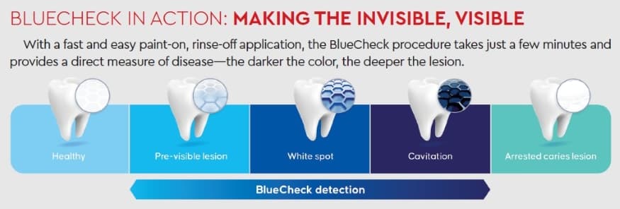 bluecheckrcja01.jpg
