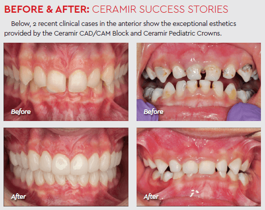 ceramirspot02.PNG