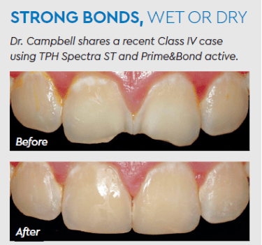 dentbond01.png