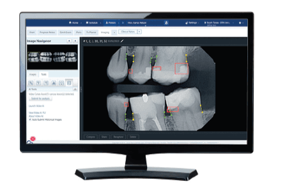 dentdetect01.png