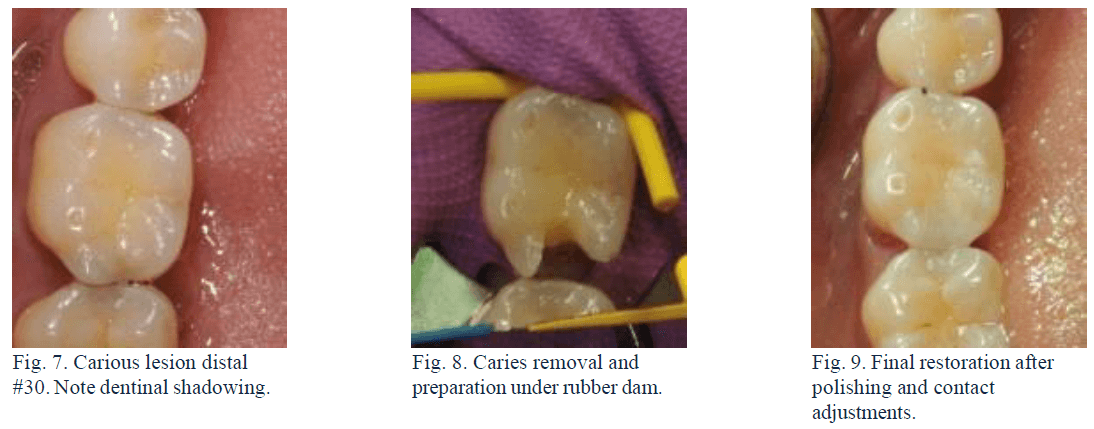 fig1ket06.png