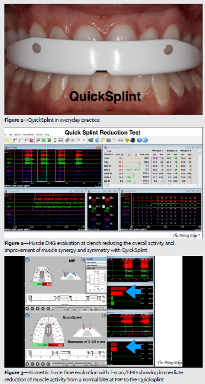 quicksplint00.png