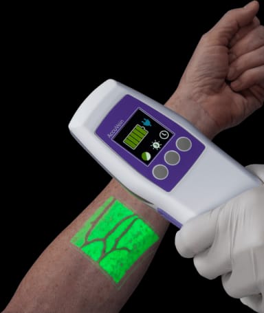 AccuVein AV500 Vein Visualization System