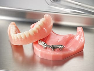 Overdenture Abutments