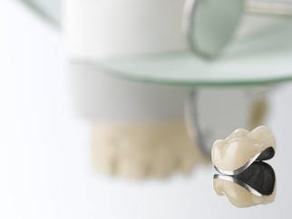 Porcelain-Fused-to-Metal