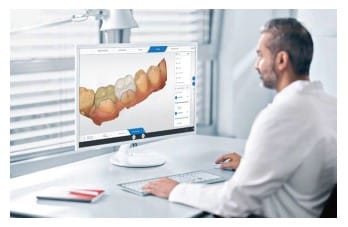 CEREC Software 5.3