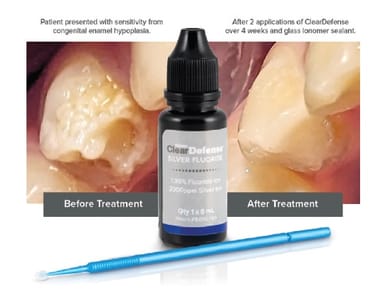  ClearDefense Silver Fluoride