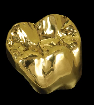 Oral Arts Dental Laboratories - Argenco Y+ Full Gold Crowns