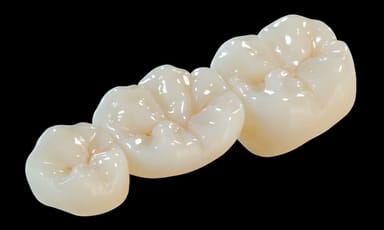 Oral Arts Dental Laboratories' BruxZir Crowns