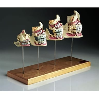 Teeth & Jaw Development Set