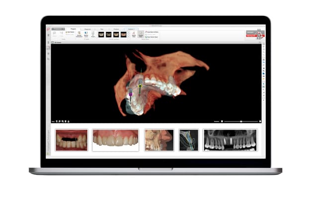 NobelClinician Software | Nobel Biocare