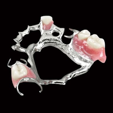 Oral Arts Dental Laboratories -Cast Vitallium Partials