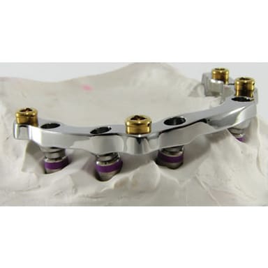 Implant Bar Overdenture