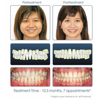 Insignia Advanced Smile Design