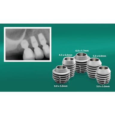 Bicon Short Implants