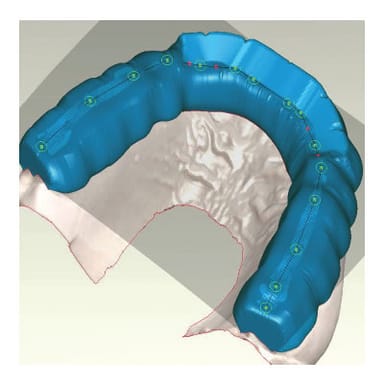 DIGITAL SPLINTS