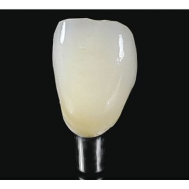 Integrated Abutment Crown