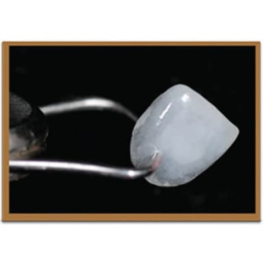 BURBANK NANO ULTRA-THIN VENEERS