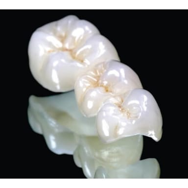 KEATING DENTAL ARTS KDZ