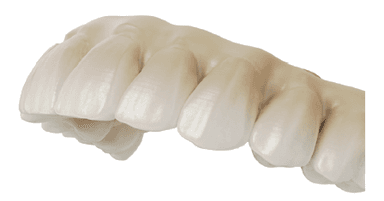 NobelProcera Esthetic Zirconia Implant Bridge