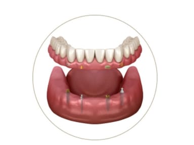 Sterngold Total Smile