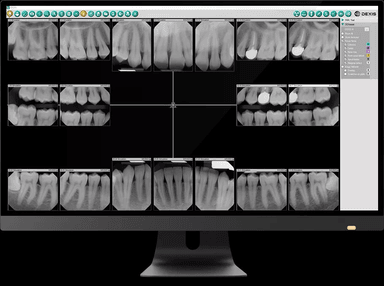 DEXIS Imaging Suite Software