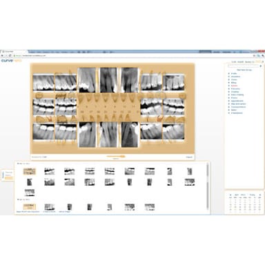 Curve Dental Web-Based Imaging Technology