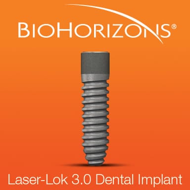 Biohorizons Laser-Lok 3.0