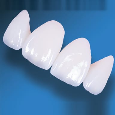 KDZ Zirconia