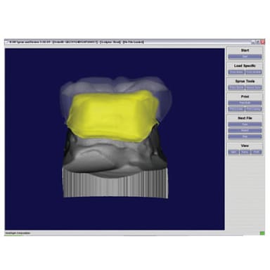LORD'S DENTAL STUDIO IPS E.MAX