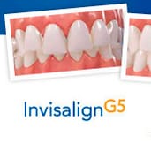 Invisalign G5