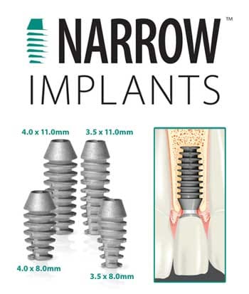 NARROW IMPLANTS