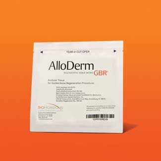 AlloDerm GBR