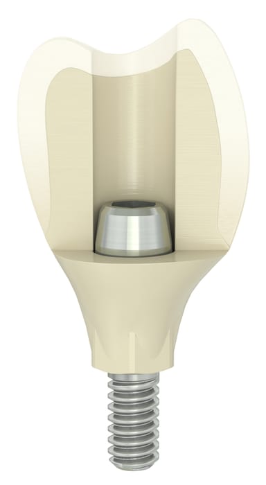 ATLANTIS Crown Abutment