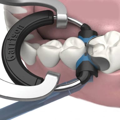 Composi-Tight 3D XR Sectional Matrix System