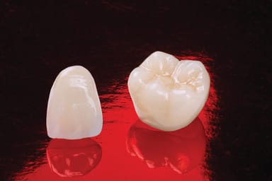 Obsidian Lithium Silicate Ceramic Crowns