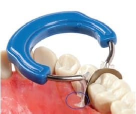 Sectional Matrix System