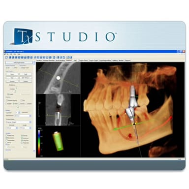 Tx Studio™ Imaging Software