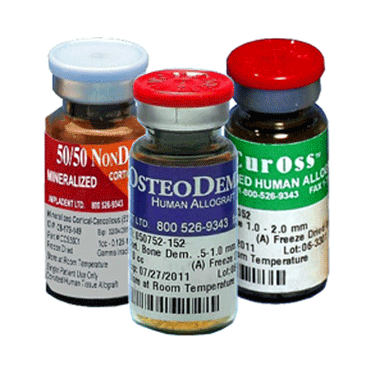 Impladent Ltds Human Bone Allografts