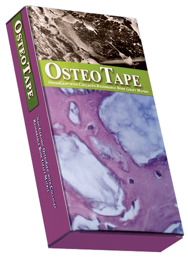 OsteoTape
