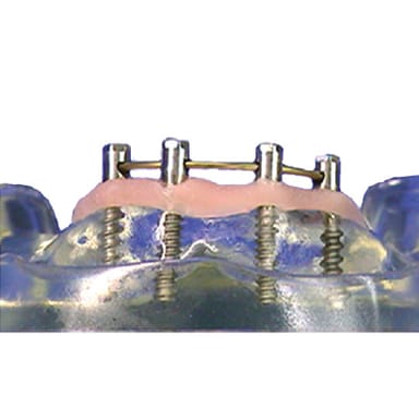 SuperSplint