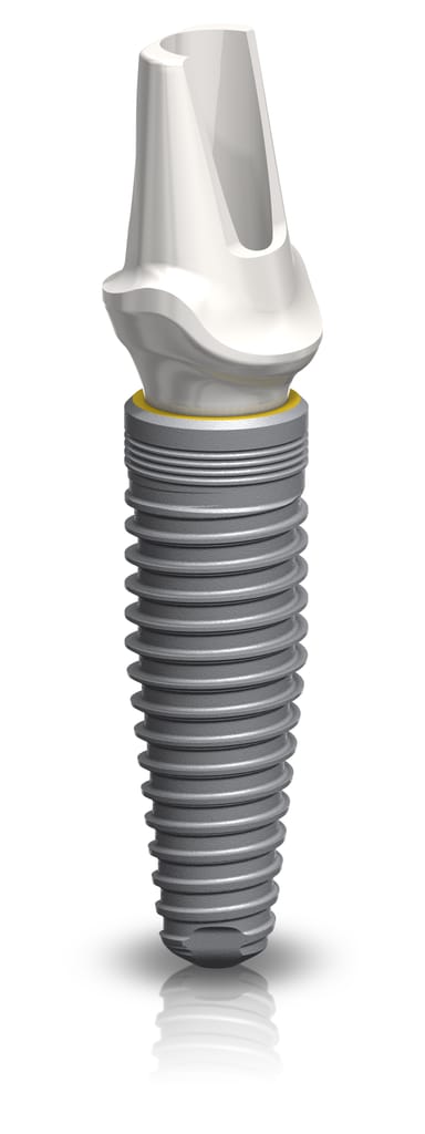 NobelReplace Conical Connection