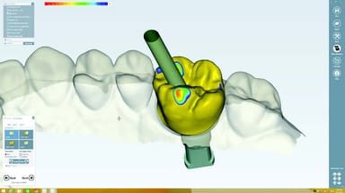 NobelDesign