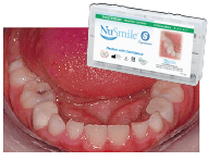NuSmile Signature Pediatric Crown - Posterior