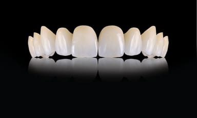 Oral Arts Dental Laboratories - IPS e.max Crowns