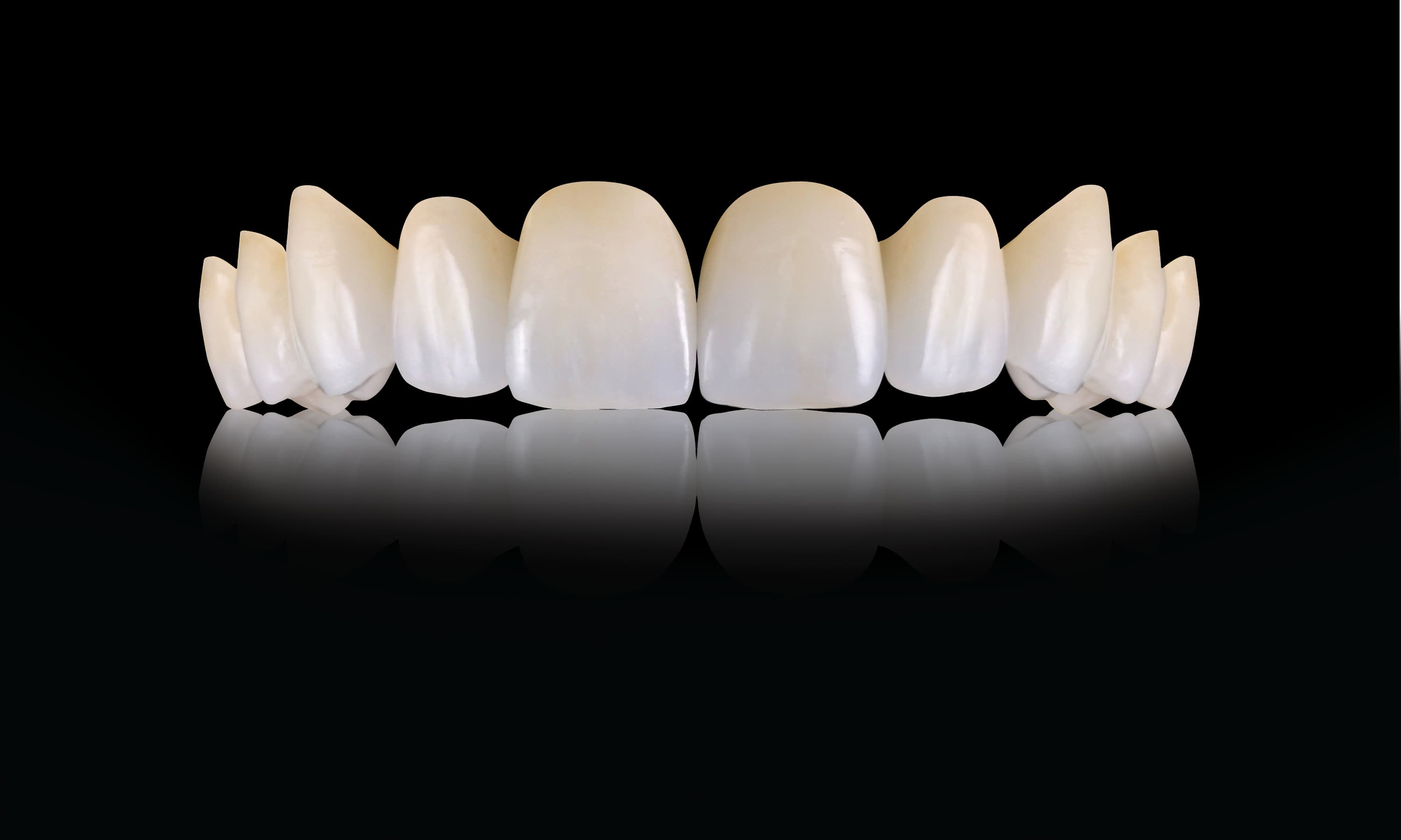 Newsfeed Thumbnail: /product_images/O/Oral_Arts_Dental_Laboratories/DPS_Web/Oral-Art_Oral-Arts-Dental-Laboratories---IPS-emax-Crowns_67211.jpg